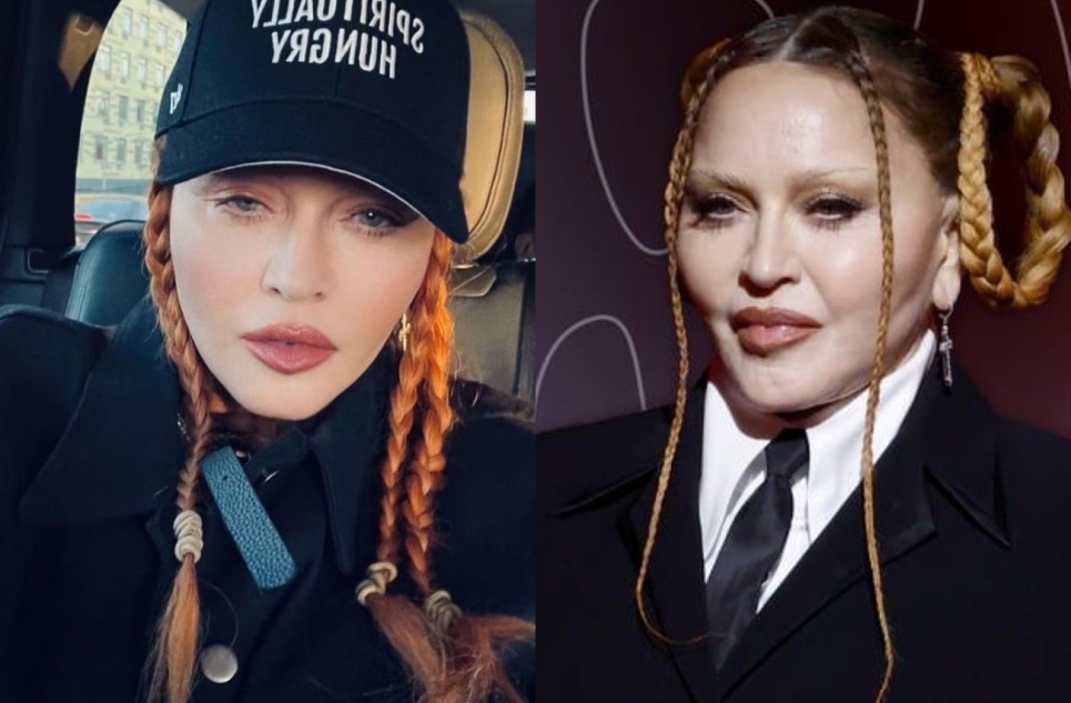 «Посмотрите, какая я привлекательная после того, как послеоперационный отек спал»: Мадонна  сделала   пластическую операцию! 