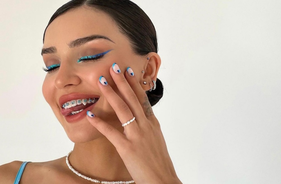 Дина Саева показала синяк под глазом